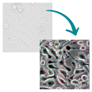 phase vs bright field contrast