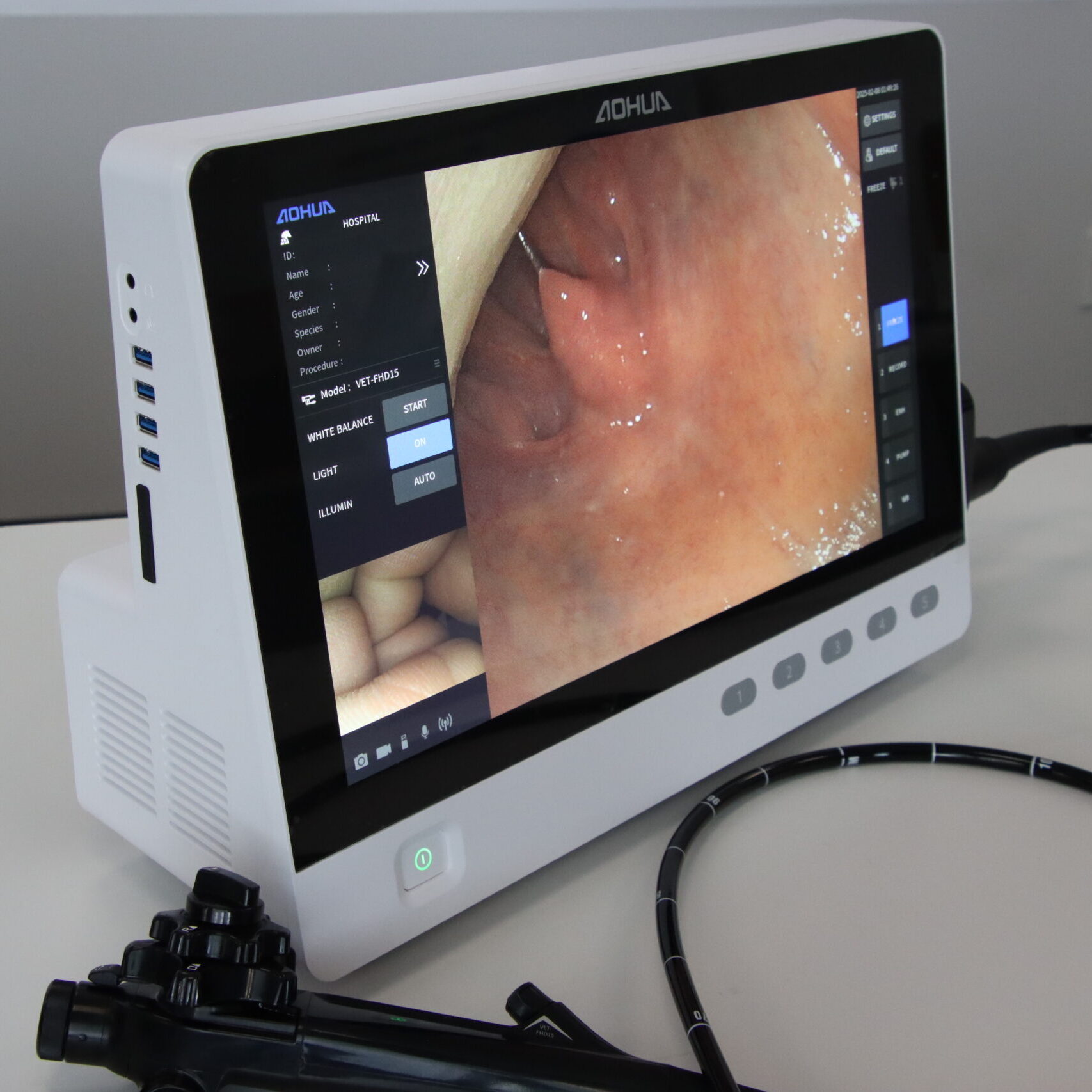 OR-160 Touch Screen Veterinary Endoscope Video Processor