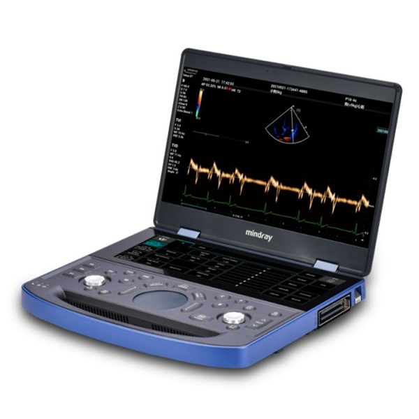 Vetus E7 — портативный УЗИ аппарат с цветным доплером 2